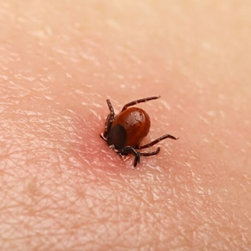Cum recunoști înțepătura de căpușă sau de purice. La ce să fii atent dacă te mușcă o insectă