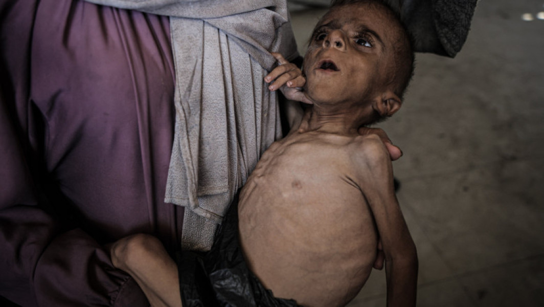 Criză alimentară în Gaza: mii de copii sub cinci ani în programe de recuperare